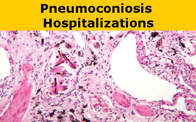 Pneumoconiosis Hospitalizations report link